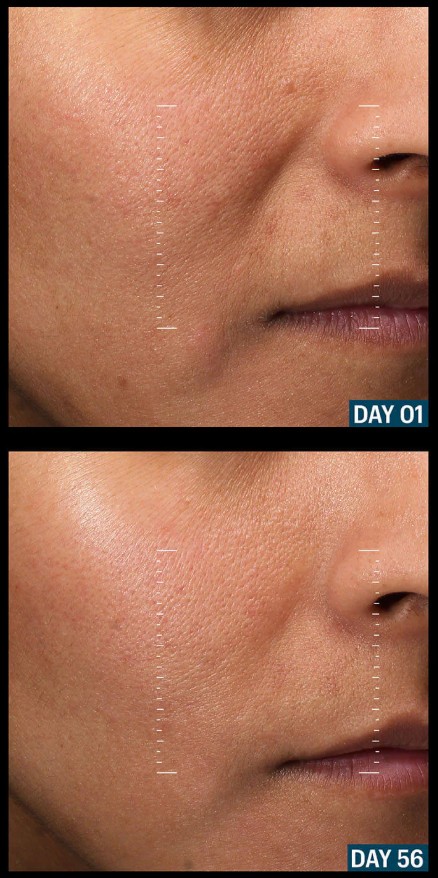 Copper Tripeptide & Ectoin Advanced Repair Serum. 91% see faster skin recovery in just 2 months.